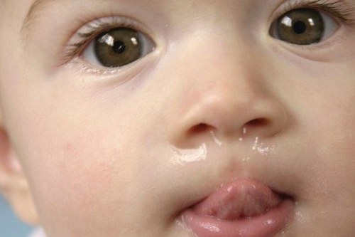 Xịt muối biển Sterimar baby dùng cho trẻ so sinh bị sổ mũi